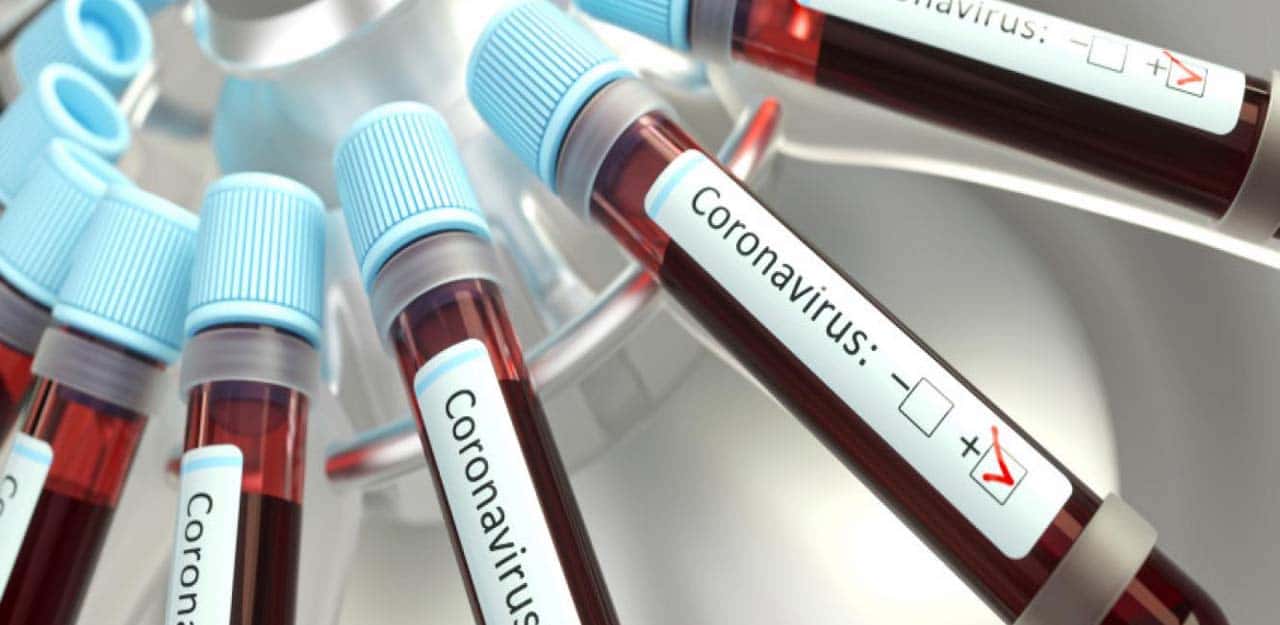 No se reportaron nuevos casos de coronavirus en la provincia