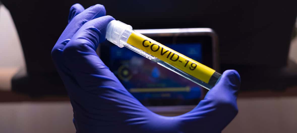Coronavirus: Confirmaron  doce casos en el  departamento 