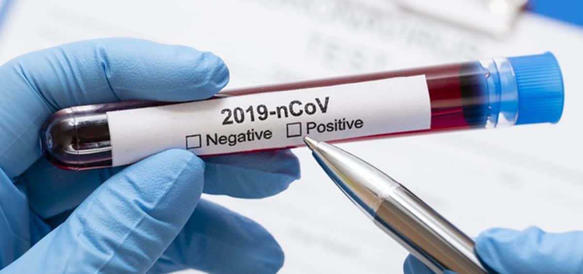 Se registraron 24 casos de coronavirus  en la cuidad en las últimas 48 horas