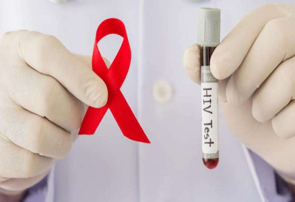 40 años de VIH, una pandemia que no se termina por causas sociales pese a los avances científicos
