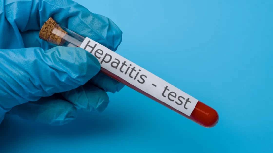 Más de la mitad de los enfermos de hepatitis no sabe que lo están, según el Hospital de Clínicas