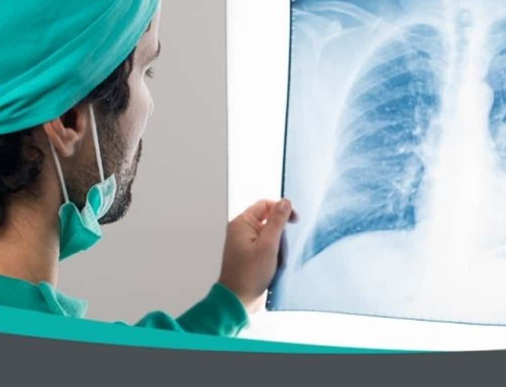 Avanza estudio para nuevas  terapias en cáncer de pulmón