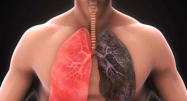 Desarrollan un compuesto que 
abre las vías pulmonares para el 
tratamiento del asma y el EPOC
